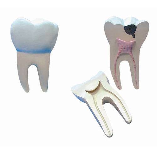 Assistência Técnica, SAC e Garantia do produto Dente Molar Ampliado - Saudável e com Cáries Anatomic - Tgd-0311-b