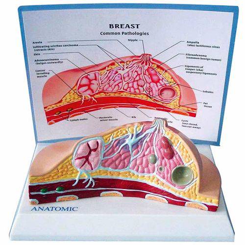 Assistência Técnica, SAC e Garantia do produto Modelo de Mama com Patologias - Anatomic - Tgd-0323-o