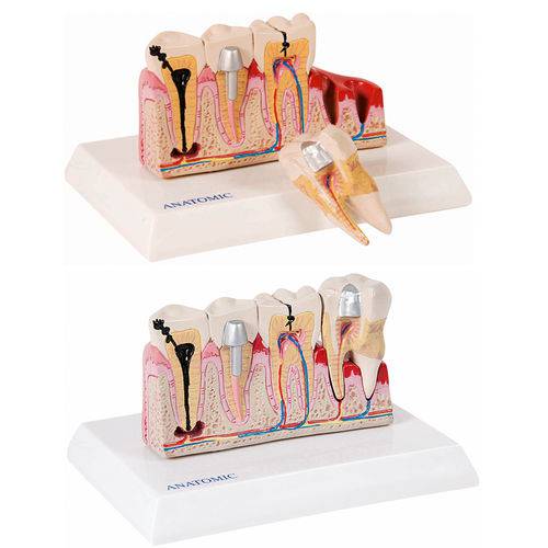 Assistência Técnica, SAC e Garantia do produto Patologia dos Dentes com Prancha Explicativa Anatomic - Tgd-0311-j