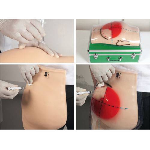 Assistência Técnica, SAC e Garantia do produto Simulador para Treino de Injeção Intramuscular Glúteo com Dispositivo de Advertência Anatomic - Tgd-4009-s