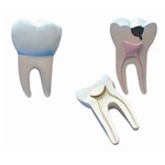 Assistência Técnica e Garantia do produto Dente Molar Ampliado - Saudável e com Cáries Anatomic - Tgd-0311-b