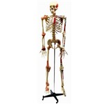 Assistência Técnica e Garantia do produto Esqueleto Aprox. 168 Cm Articulado e Muscular - Anatomic - Cód: Tgd-0101-a