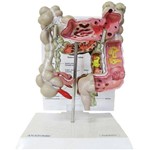 Assistência Técnica e Garantia do produto Intestino Grosso Patológico Anatomic - Código: Tgd-0329-g